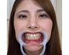 【歯フェチ】愛乃零ちゃんの歯を観察しました！