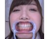 【歯フェチ】美泉咲ちゃんの歯を観察しました！【特典動画付】