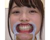 【歯フェチ】宮沢ちはるちゃんの歯を観察しました！