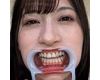 【歯フェチ】藤井レイラちゃんの歯を観察しました！