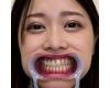 【歯フェチ】野咲美桜さんの歯を観察しました！