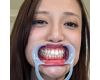 【歯フェチ】中村日咲ちゃんの歯を観察しました！