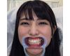 【歯フェチ】倉木しおりちゃんの歯を観察しました！