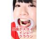 Many teeth of silver Adachi Madoka-chan