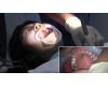 究極の歯フェチ作品！ガチ歯科治療美少女若菜しずく（22歳）銀歯2箇所埋め込み治療