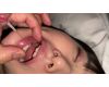 現役JDの透き通る肌と口内炎 ハルナ� KITR00276