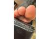Extremely Stinky Feet After a Night Out