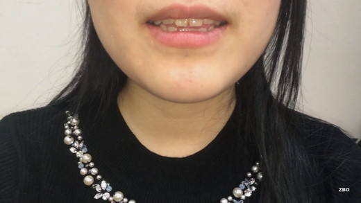 Gcolle 【のどちんこ】現役女子大生の無防備な口内探訪！清楚な笑顔と、大きく開けた口の奥…舌出し＆喉の奥までじっくり観察 2003d2kt01-1.mp4 983181