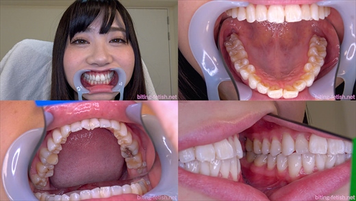 【歯フェチ】一ノ瀬恋ちゃんの歯を観察しました！ gallery photo 1