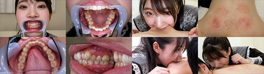 【特典動画付】皆月ひかるの歯と噛みつきシリーズ1〜2まとめてDL gallery photo 1