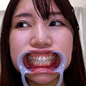 Gcolle 【歯フェチ】美丘さとみさんの歯を観察しました！ 985824