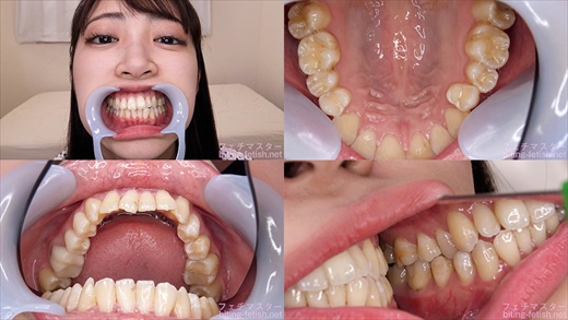 【歯フェチ】加賀美さらちゃんの歯を観察しました！ gallery photo 1