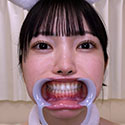 Gcolle 【歯フェチ】道久てんちゃんの歯を観察しました! 992088