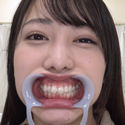 【歯フェチ】弥生みづきちゃんの歯を観察しました！