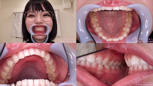 【歯フェチ】初愛ねんねちゃんの歯を観察しました！ gallery photo 1