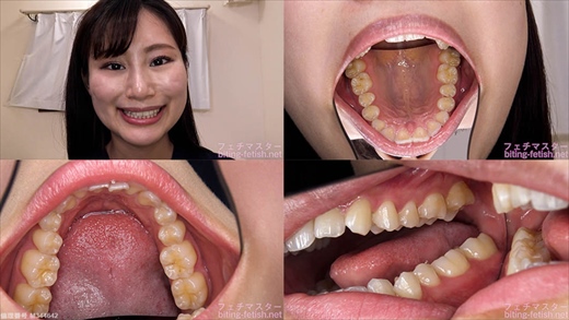 【歯フェチ】堀内美香ちゃんの歯を観察しました！ gallery photo 1