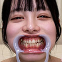 Gcolle 【歯フェチ】月見若葉ちゃんの歯を観察しました！ 987633
