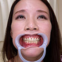 Gcolle 【歯フェチ】伊東沙蘭さんの歯を観察しました！ 971095