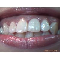 Oral Conditions of Beautiful Ladies [20040204]