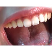 Oral Conditions of Beautiful Ladies [20020205]
