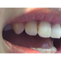 Oral Conditions of Beautiful Ladies [20050201]