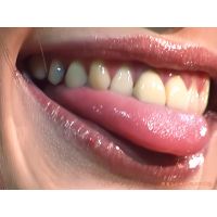 Oral Conditions of Beautiful Ladies [20040102]