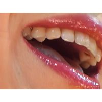Oral Conditions of Beautiful Ladies [20030102]