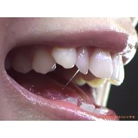 Oral Conditions of Beautiful Ladies [20050204]