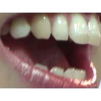 Oral Conditions of Beautiful Ladies [20040205]