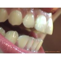 Oral Conditions of Beautiful Ladies [20030304]