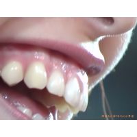 Oral Conditions of Beautiful Ladies [20020203]