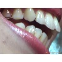 Oral Conditions of Beautiful Ladies [20050203]