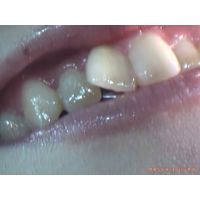 Oral Conditions of Beautiful Ladies [20050104]