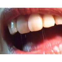 Oral Conditions of Beautiful Ladies [20040306]