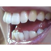 Oral Conditions of Beautiful Ladies [20030306]