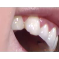 Oral Conditions of Beautiful Ladies [20030105]