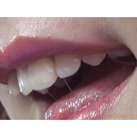 Oral Conditions of Beautiful Ladies [20040302]