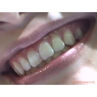 Oral Conditions of Beautiful Ladies [20020405]