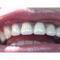 Oral Conditions of Beautiful Ladies [20040103]
