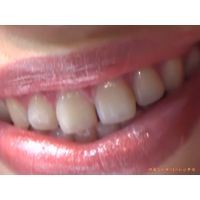 Oral Conditions of Beautiful Ladies [20050106]
