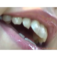 Oral Conditions of Beautiful Ladies [20020401]