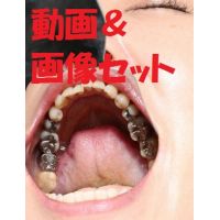 Teeth of ShihoMovie & Photo