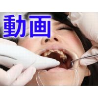 すみれちゃんの銀歯と欠損2 動画「歯医者行ったら全部銀歯に・・・」　