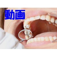 Teeth of Haru RETURNSMovie