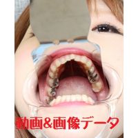 Teeth of Karen Movies&Photo