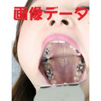 Teeth of YuriPhoto