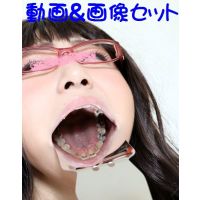 Teeth of MEGUMI Movie&Photo