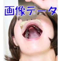 Teeth of Yuki Photo