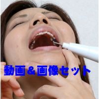Haru teeth Movie&Photo