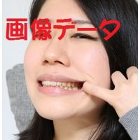 Teeth of Misaki Photo